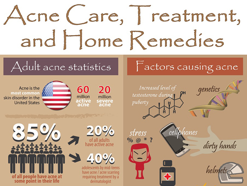 Acne Care, Treatment, and Home Remedies (Infographics)