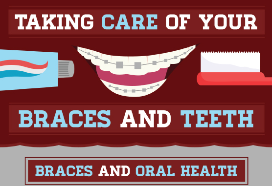 Taking Care of Your Braces and Teeth