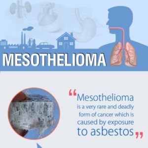 Stages of Mesothelioma