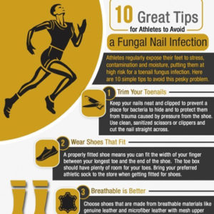 10 Things Athletes Need to Know to Avoid a Toenail Fungal Infection