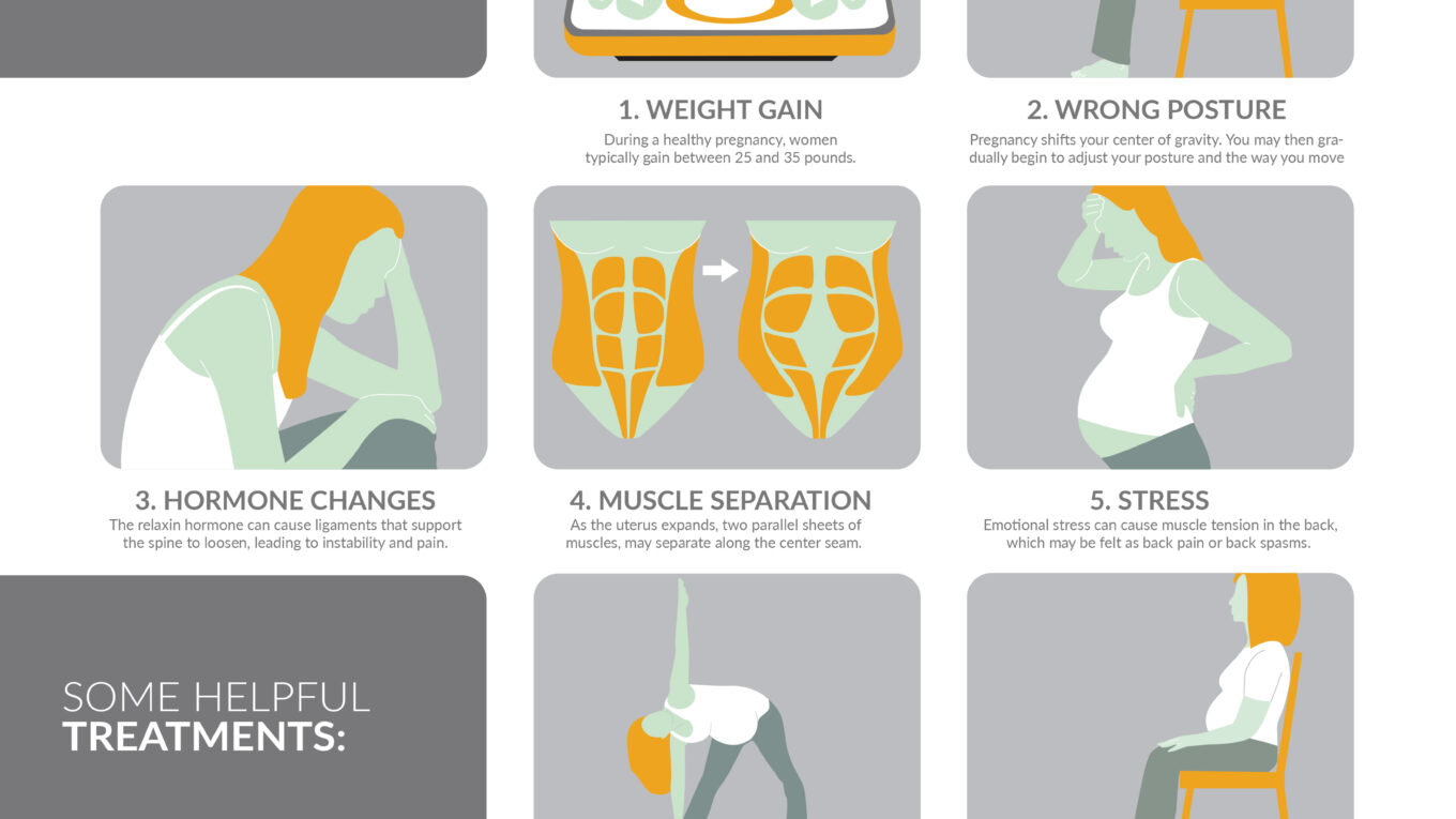 Back Pain During Pregnancy