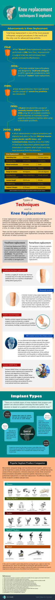 10-Minute Guide to Knee Replacement