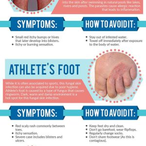 How to Avoid Summer Rashes and other Skin Problems