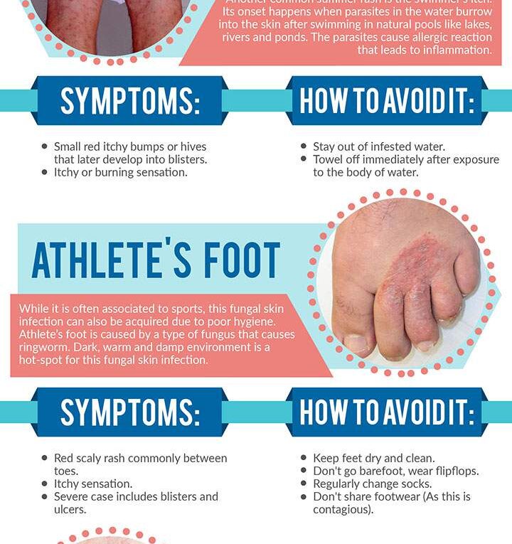 How to Avoid Summer Rashes and other Skin Problems