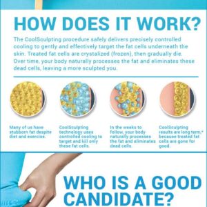 Coolsculpting in Seattle: A guide to the most frequently asked questions at Well Medical Arts