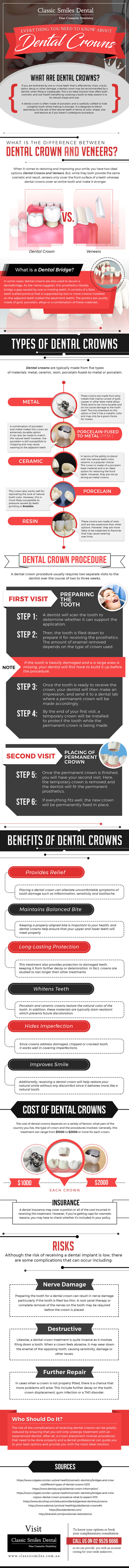 Everything You Need To Know About Dental Crowns