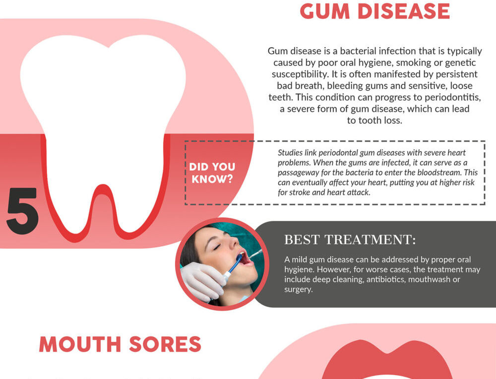 Top 10 Dental Problems and Your Best Treatment Options