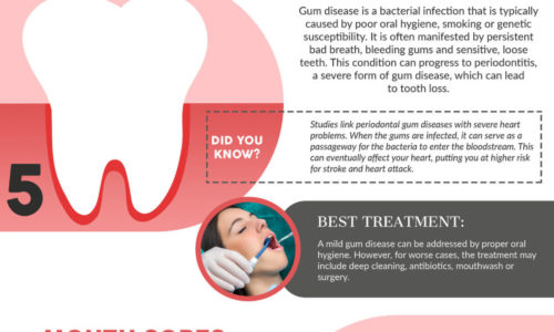 Top 10 Dental Problems and Your Best Treatment Options (2)