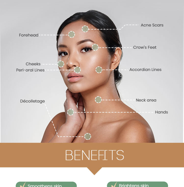 Restylane Skinboosters: Your Guide To Deep Skin Hydration