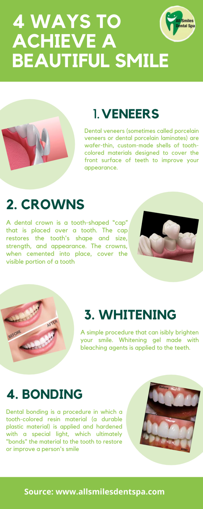 4 Ways to Achieve a Beautiful Smile | All Smiles Dental Spa Dubai