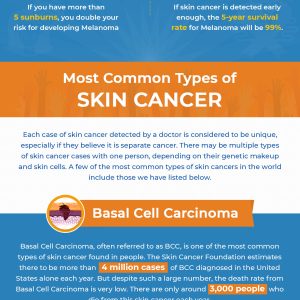 Skin Cancer – Don’t Let These Two Words Scare You