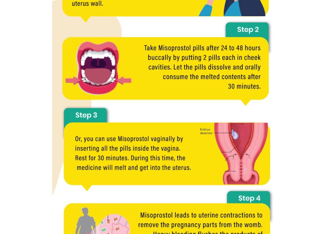 How to Safely Use MTP Kit Pills?